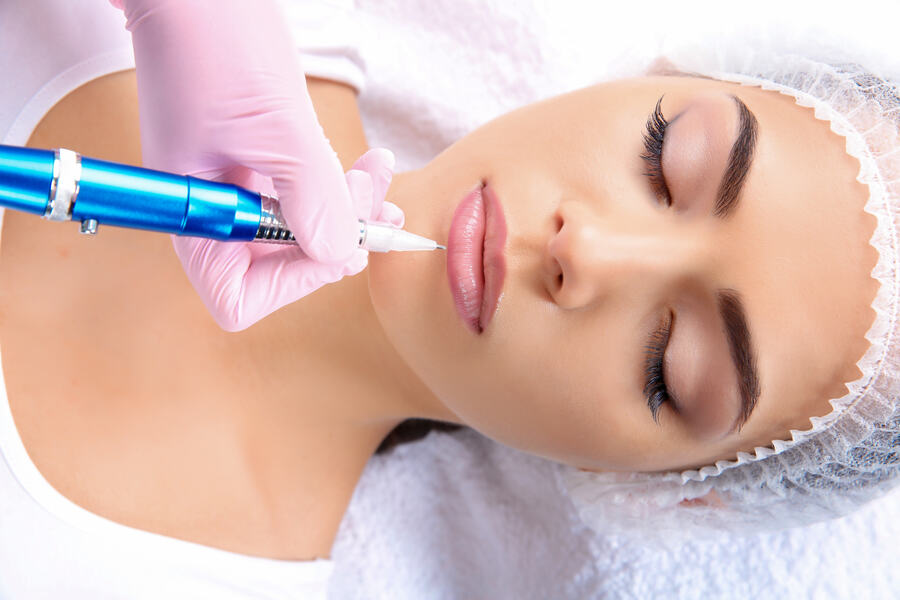 Laser hair removal